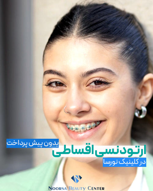 هزینه ارتودنسی دندان
