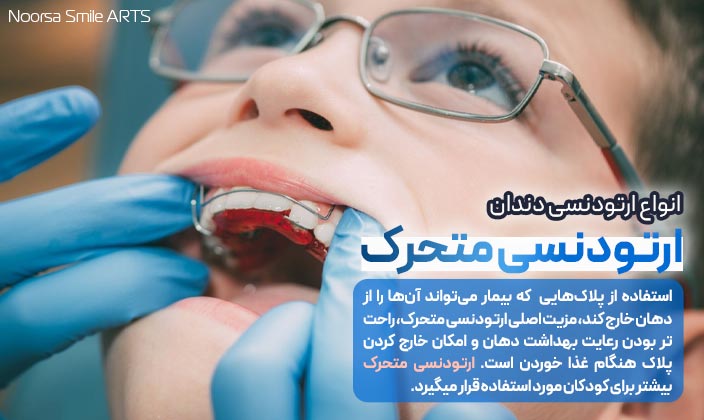 ارتودنسی متحرک دندان