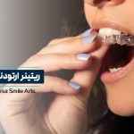 ریتینر ارتودنسی