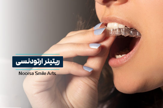 ریتینر ارتودنسی