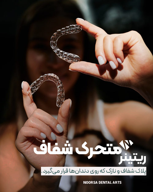 ریتینر متحرک شفاف دندان