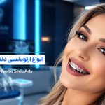 انواع ارتودنسی دندان