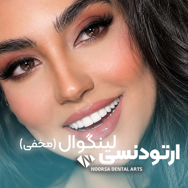 ارتودنسی لینگوال مخفی
