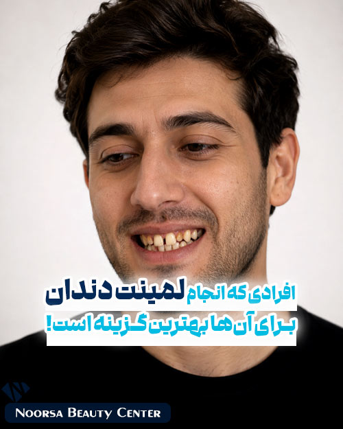 لمینت دندان بهترین گزینه درمان زیبایی دندان