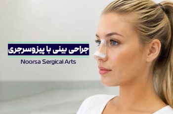 جراحی بینی با پیزوسرجری