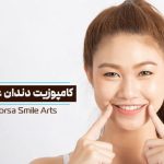 کامپوزیت دندان عقب