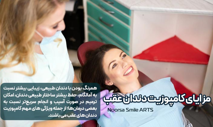 مهمترین مزایای کامپوزیت دندان عقب یا کناری