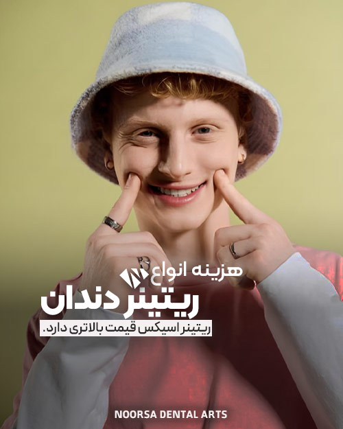 هزینه انواع ریتینر دندان