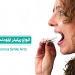 انواع ریتینر دندان