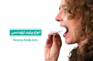 انواع ریتینر دندان