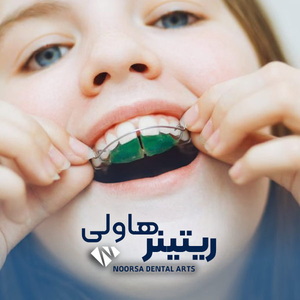 ریتینر هاولی