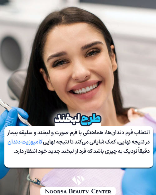 طرح لبخند کامپوزیت دندان