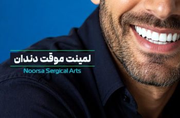 لمینت موقت دندان