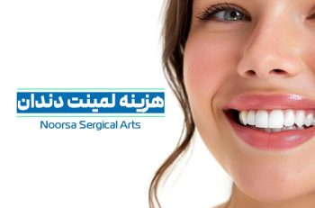هزینه لمینت دندان