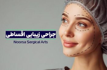جراحی زیبایی اقساطی