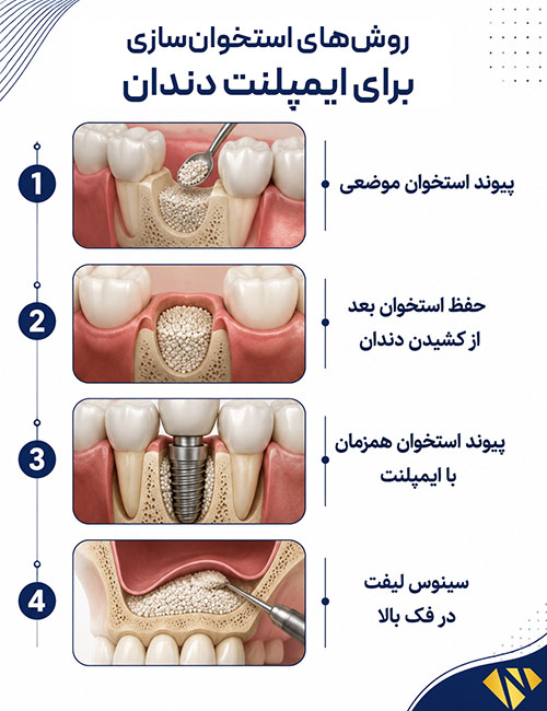 روشهای استخوانسازی برای ایمپلنت دندان