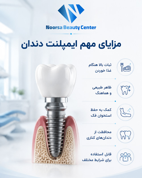 مزایای ایمپلنت دندان