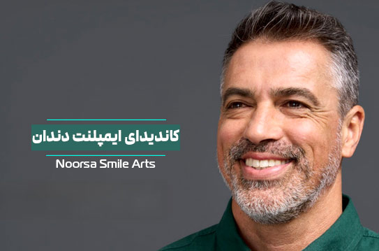 کاندیدای مناسب ایمپلنت دندان