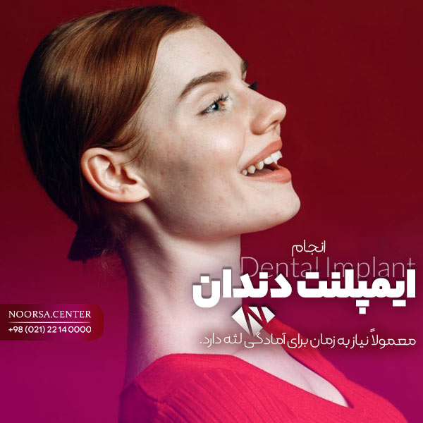 مراحل ایمپلنت دندان