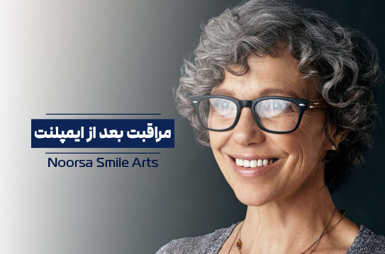 مراقبت های بعد از ایمپلنت دندان