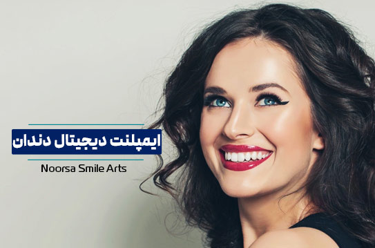 ایمپلنت دیجیتال دندان