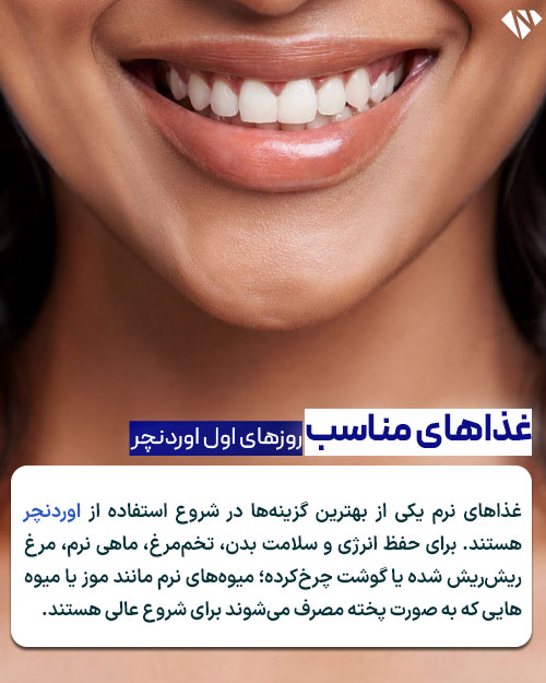 غذاهای مناسب برای روز های اولیه اوردنچر