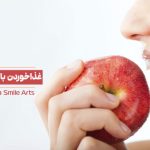 راهنمای کامل غذا خوردن با اوردنچر دندان