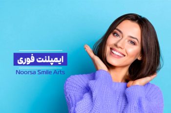 ایمپلنت فوری دندان