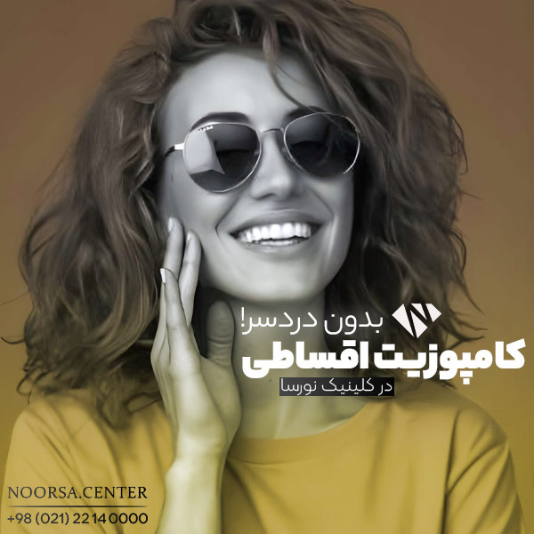 کامپوزیت اقساطی بدون دردسر