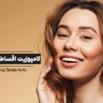 کامپوزیت اقساطی دندان