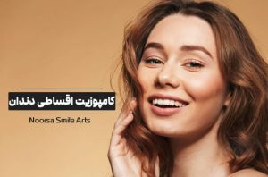 کامپوزیت اقساطی دندان
