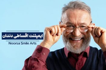 ایملپنت اقساطی دندان