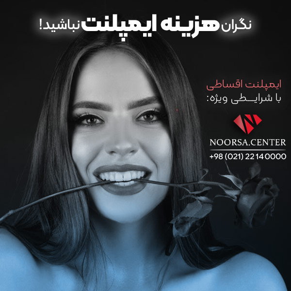 ایمپلنت اقساطی در کلینیک نورسا