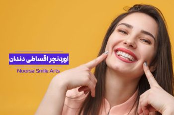 اوردنچر اقساطی در تهران