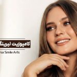 کامپوزیت لیرینگ دندان