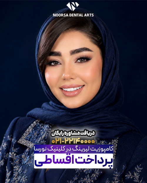 پرداخت اقساطی کامپوزیت لیرینگ