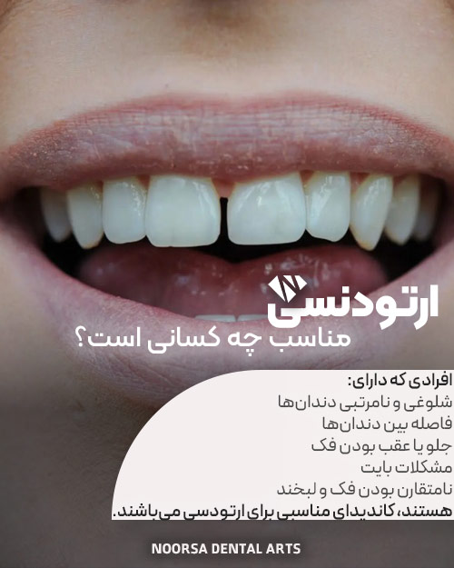 ارتودنسی دندان برای چه کسانی مناسب است