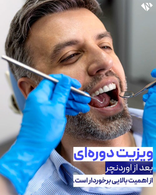اهمیت بازدید دوره ای از اوردنچر