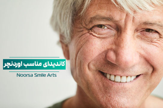 کاندیدای مناسب اوردنچر دندان