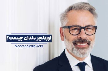 اوردنچر دندان