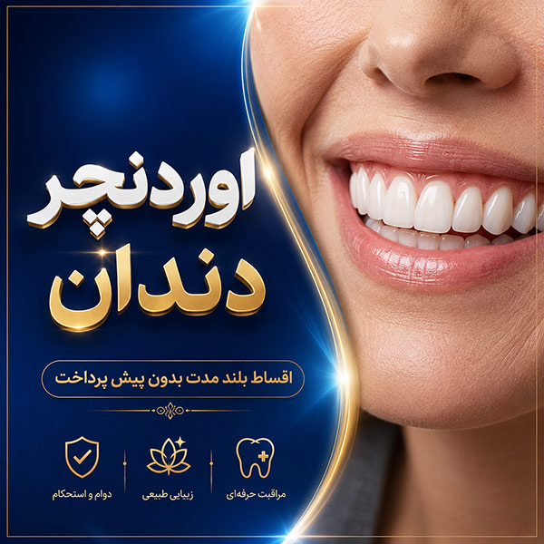 اوردنچر اقساطی