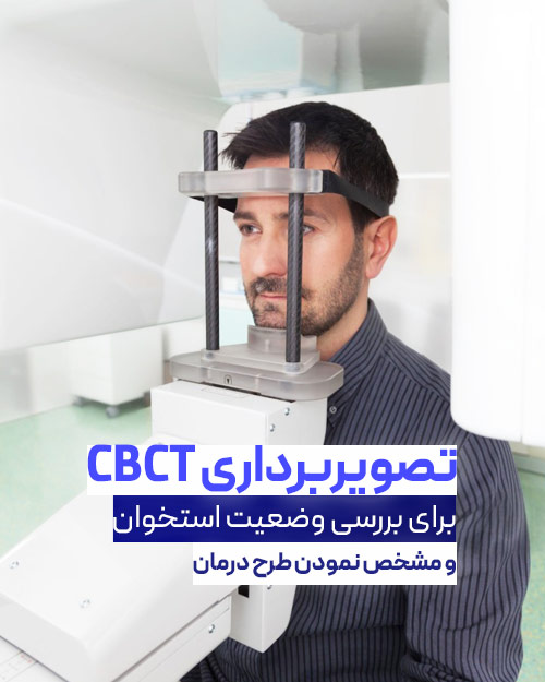 تصویربرداری CBCT برای اوردنچر