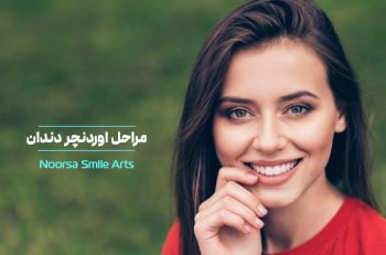 مراحل اوردنچر دندان