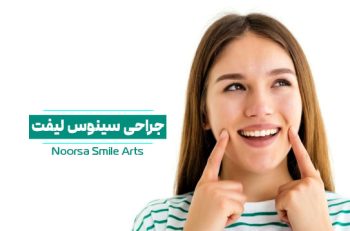 جراحی لیفت سینوس برای ایمپلنت دندان