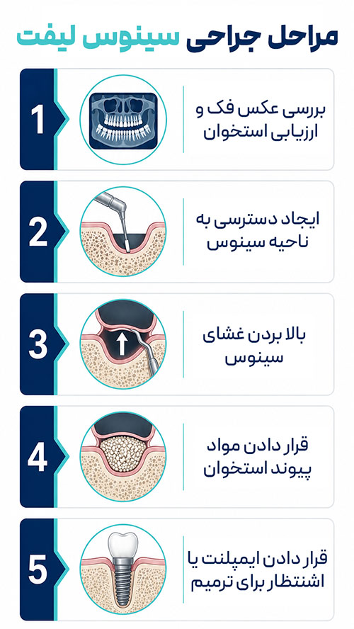 مراحل جراحی سینوس لیفت