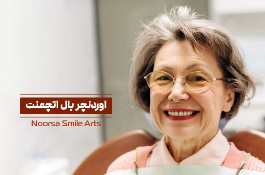 اوردنچر بال اتچمنت چیست
