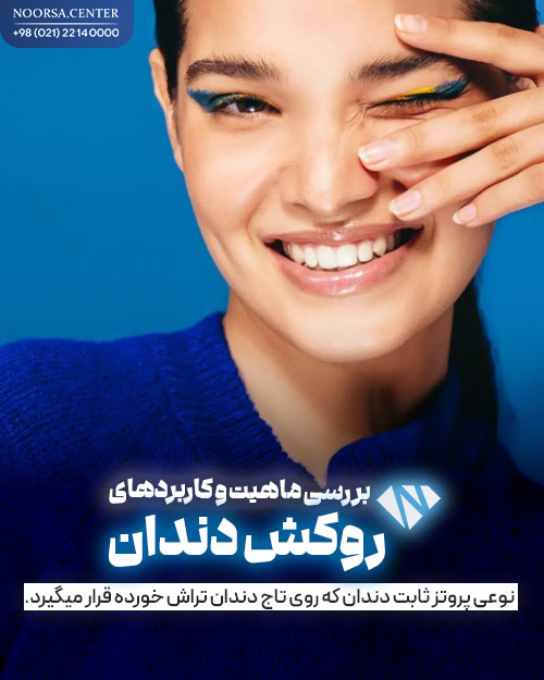 روکش دندان و کاربردهای آن