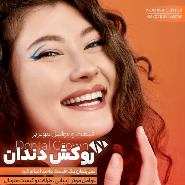 قیمت روکش دندان در ایران و عوامل موثر بر هزینه روکش دندان