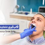 قالب‌گیری دندان مصنوعی چگونه است؟ از روش‌های سنتی تا اسکن دیجیتال