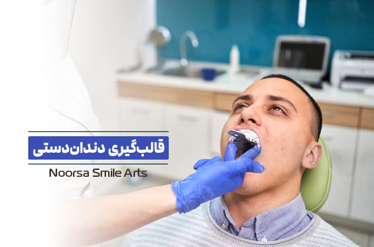 قالب‌گیری دندان مصنوعی
